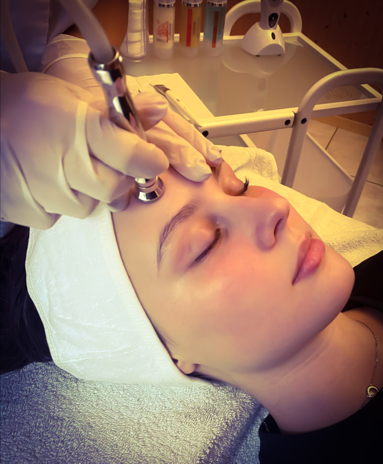 microdermabrasion